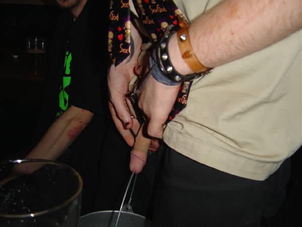 Penile Suspension